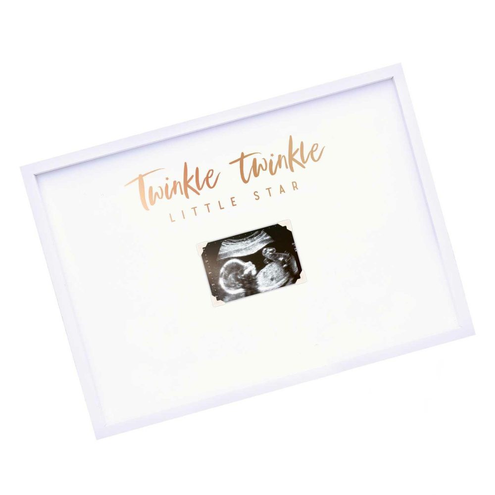 Baby Shower Gifts |   Baby Scan Frame Baby Shower Guest Book Alternative Baby Shower Baby Shower Gifts